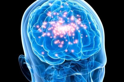 Epilepsia en el cerebro